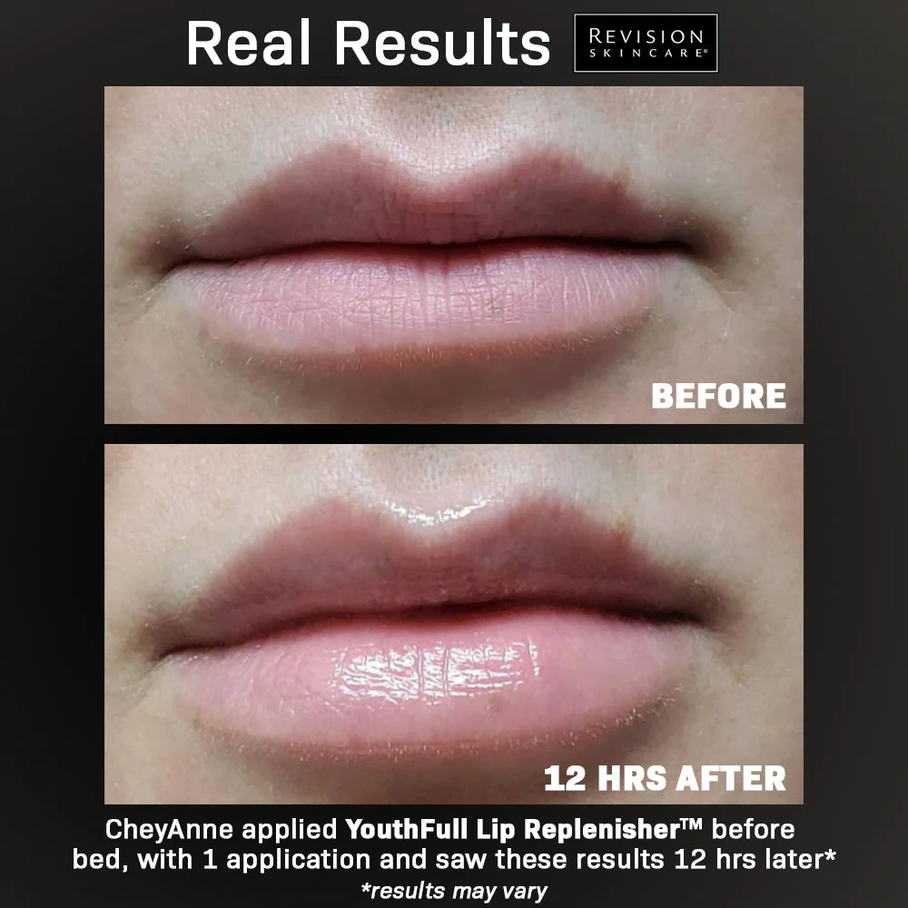 Youthful Lip Replenisher by Revision Skincare